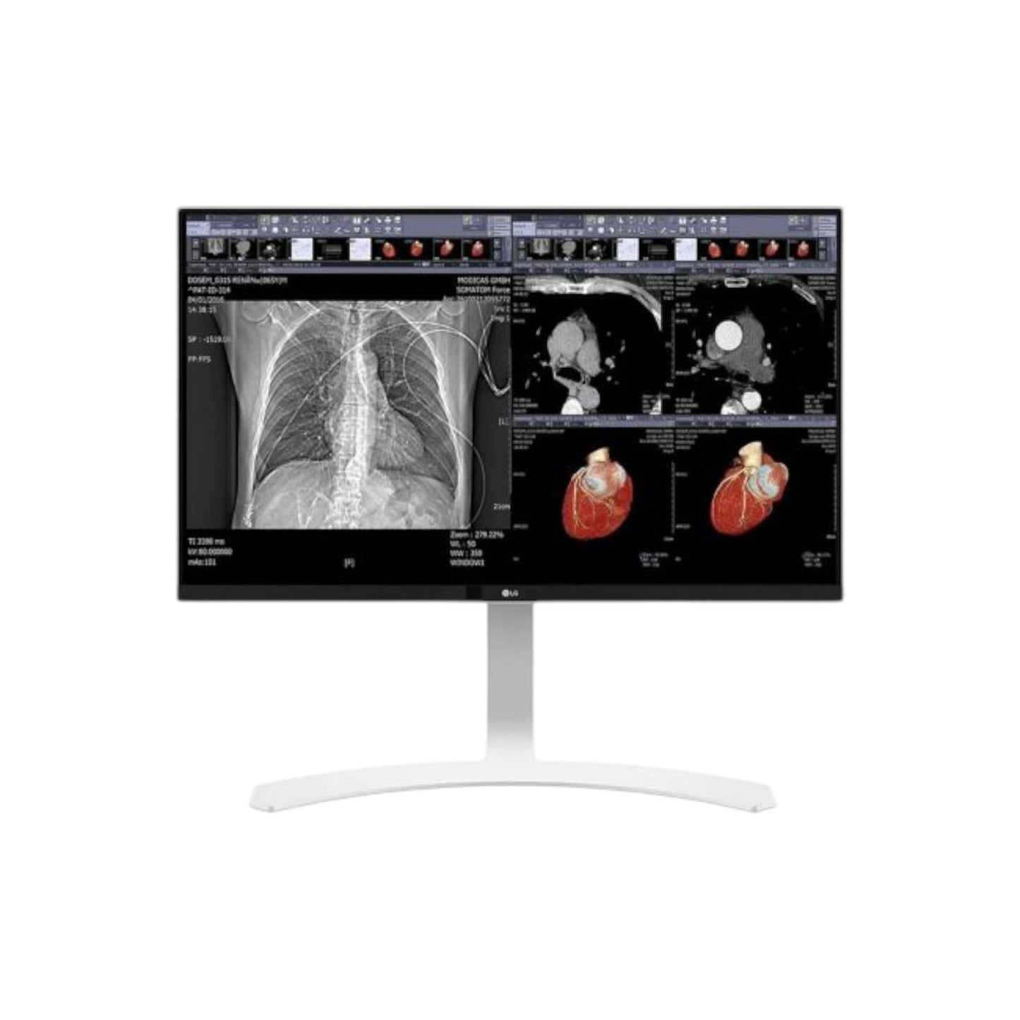 LG 27HJ712C-W 27-Inch 8MP Clinical Review Monitor