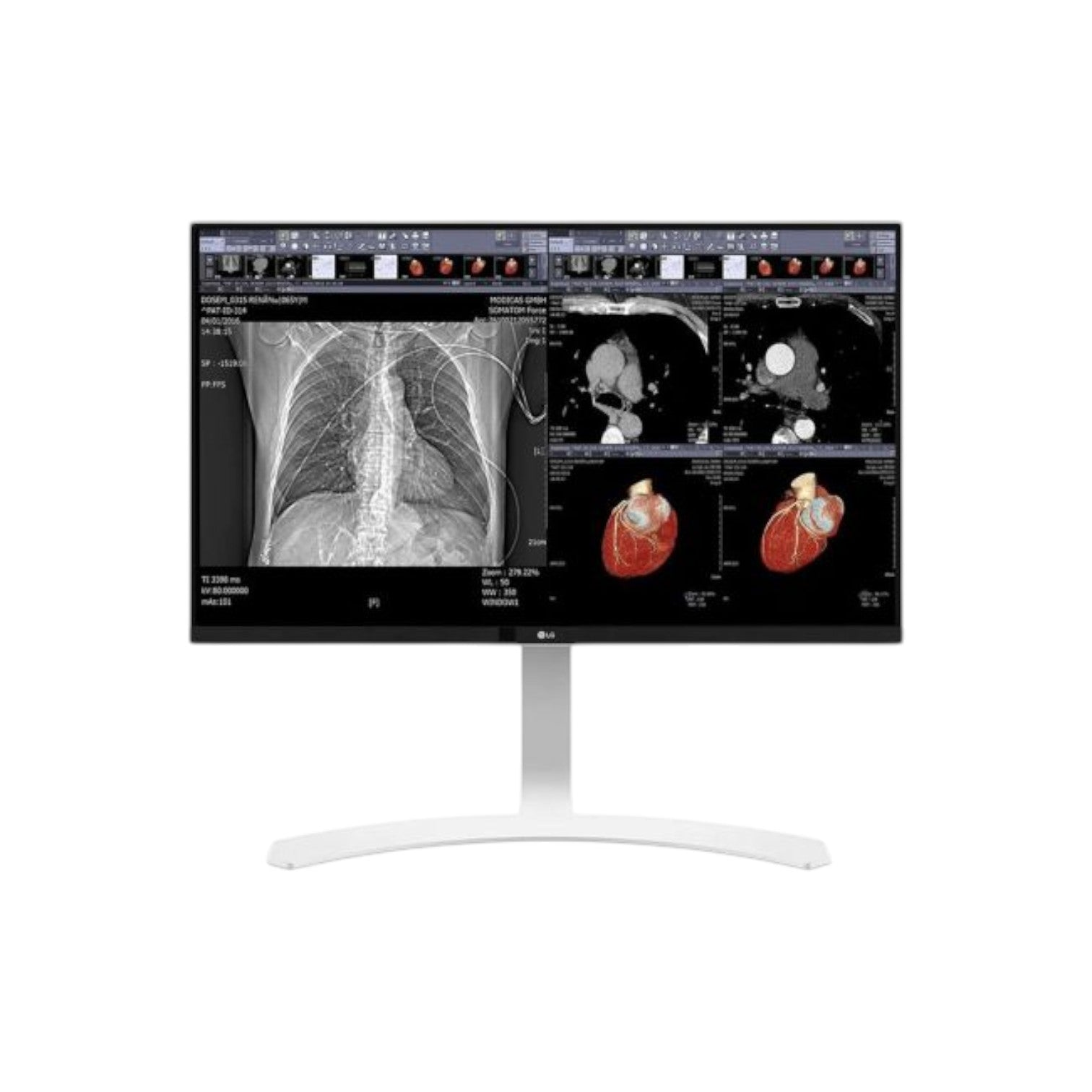 LG 27HJ712C-W 27-Inch 8MP Clinical Review Monitor