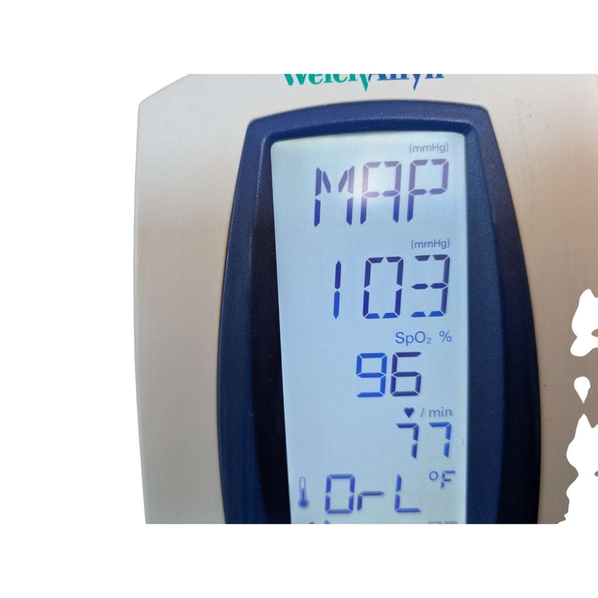 Welch Allyn Spot Vital Signs Blood Pressure Monitor on Rolling Stand