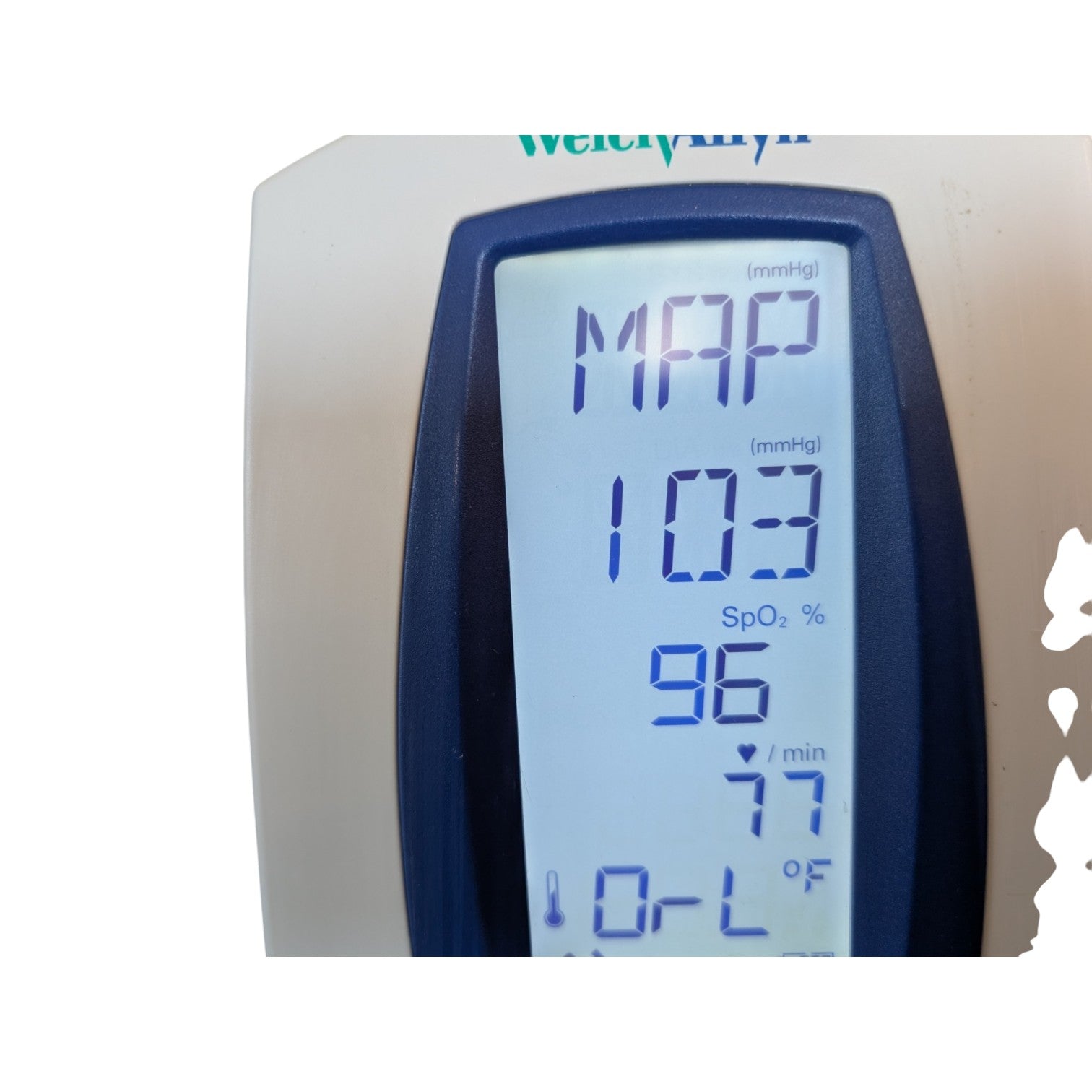 Welch Allyn Spot Vital Signs Blood Pressure Monitor on Rolling Stand