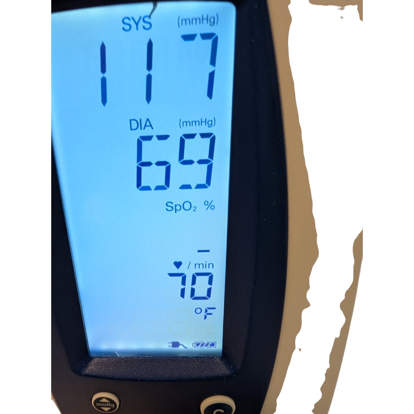 Welch Allyn Spot Vital Signs Blood Pressure Monitor on Rolling Stand