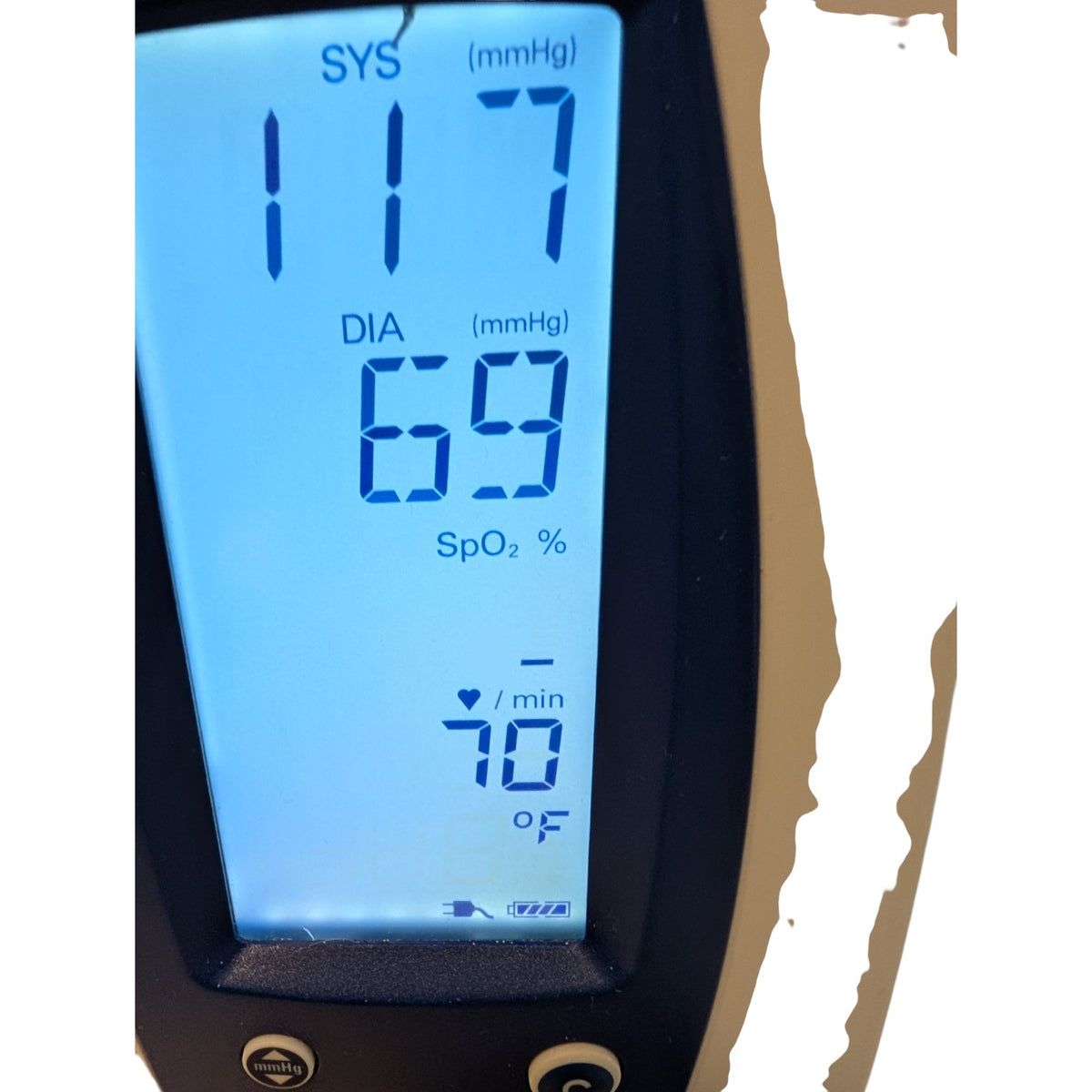 Welch Allyn Spot Vital Signs Blood Pressure Monitor on Rolling Stand